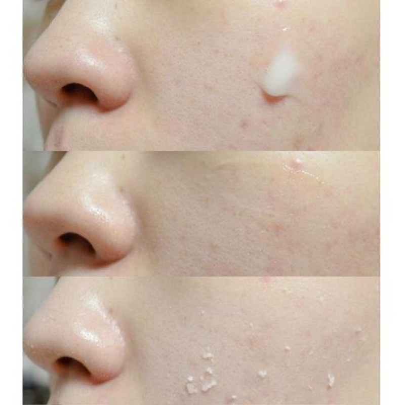 3W Clinic Tẩy Tế Bào Chết 180ml