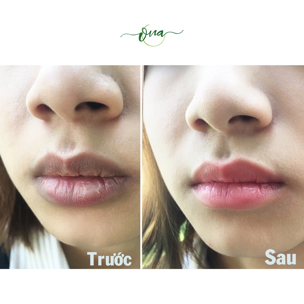 SON DƯỠNG MÔI thiên nhiên ONA giúp HỒNG MÔI, MỀM MỊN VÀ MỜ THÂM sau 3-4 tuần | BigBuy360 - bigbuy360.vn