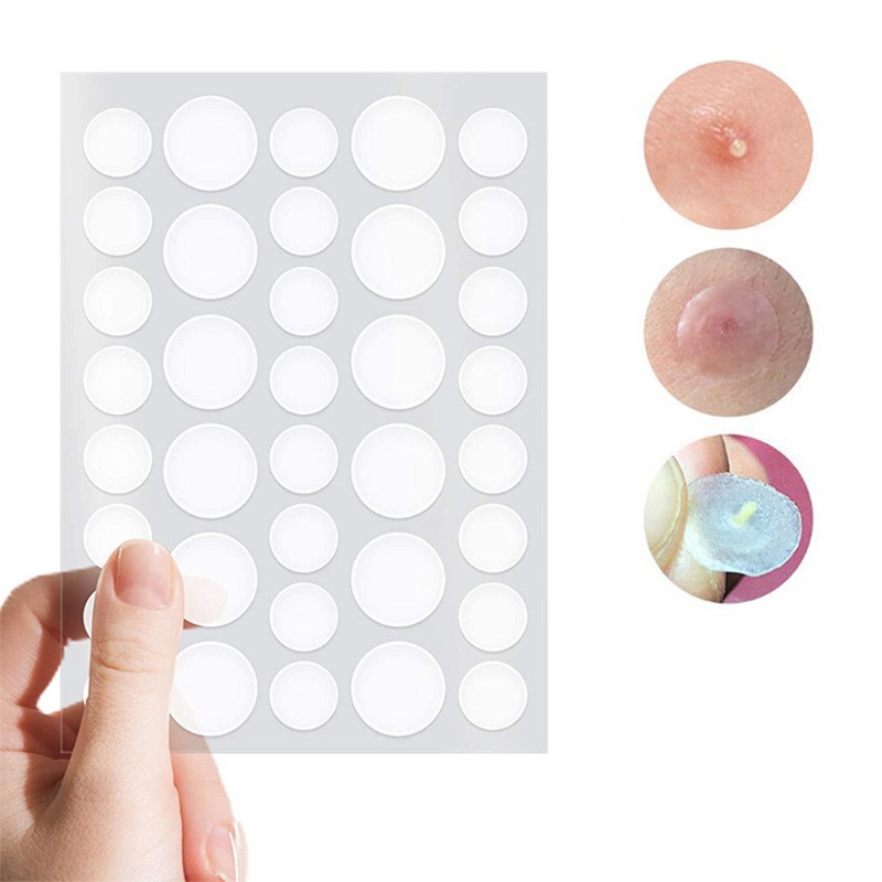 Set 3 Miếng Dán 108 Miếng Dán Mụn Trứng Cá Hấp Thụ Tốt