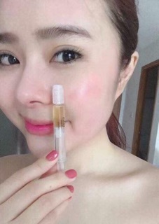 ELDAS TẾ BÀO GỐC HUYẾT THANH