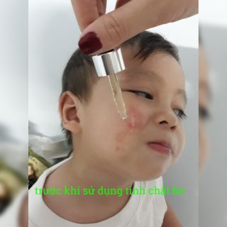 Tinh Chất Bơ 5ml
