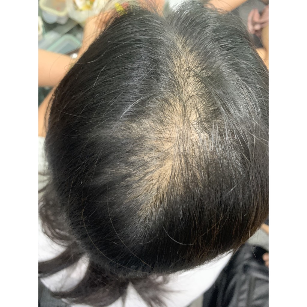 [NHẬP KHẨU] Dầu gội thảo dược Shine Water kích thích mọc tóc, giúp tóc chắc khỏe, vào nếp HOT tại Hàn Quốc