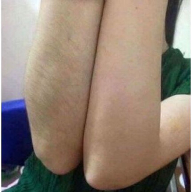 Kem Tẩy lông Kone Thái Lan Chính Hãng  An Toàn Hiệu quả | BigBuy360 - bigbuy360.vn