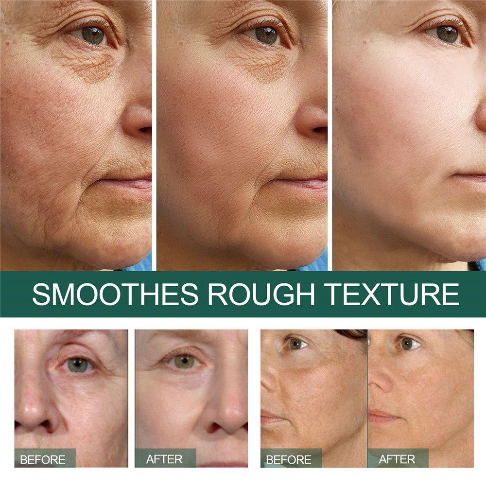 DIACHAVN Serum Dưỡng Ẩm Sâu Làm Trắng Da Chống Nếp Nhăn Và Lão Hóa 30ml