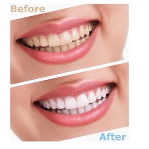 Kem Đánh Răng Crest 3D White Advanced Triple Whitening 158gram nội địa Mỹ SeeMe beauty BF-010-032