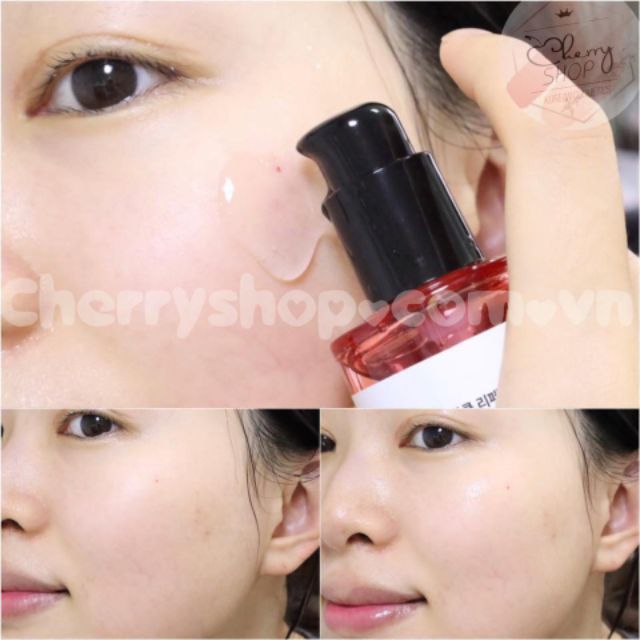 Tinh chất làm mờ sẹo, dưỡng trắng some by mi snail truecica miracle repair 50ml | BigBuy360 - bigbuy360.vn