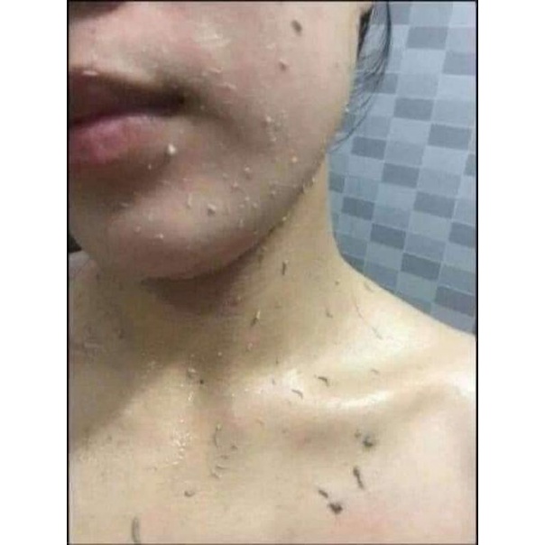 Tẩy Da Chết Vật lý