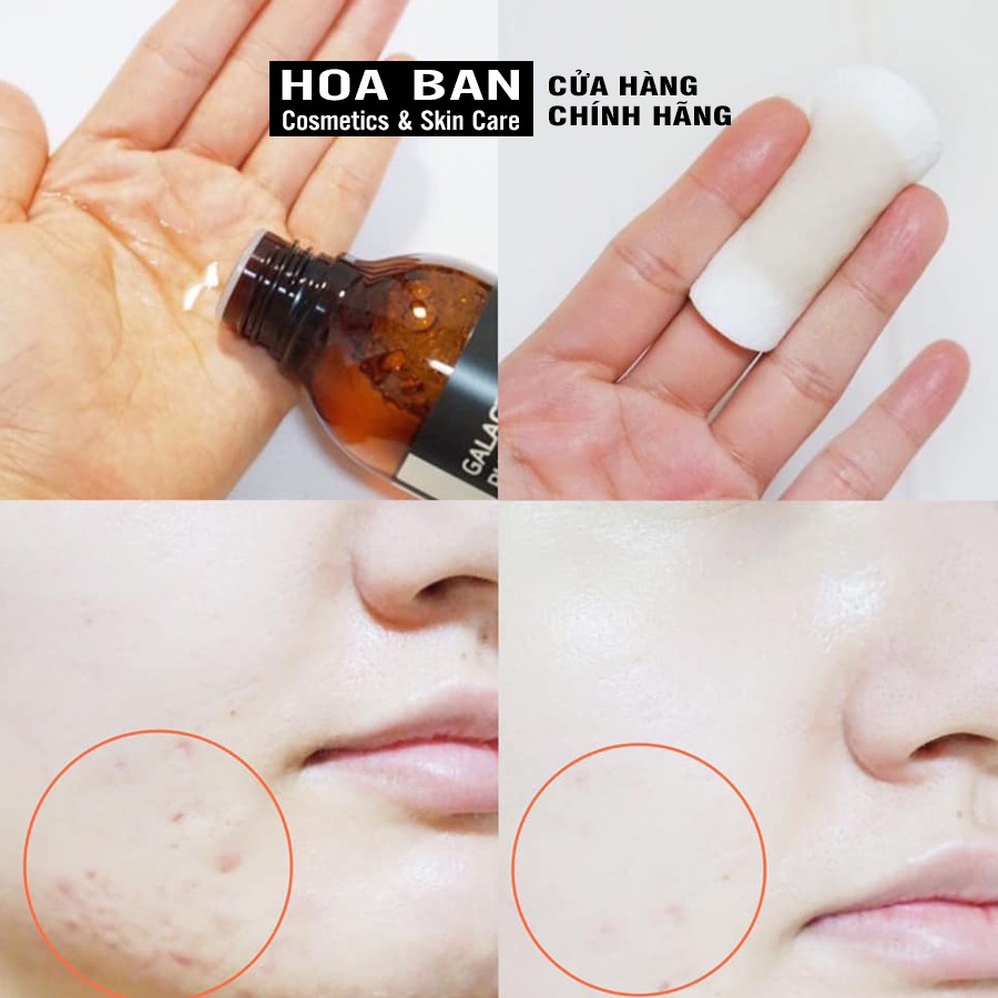 Toner Dưỡng Trắng Some By Mi Galactomyces Pure Vitamin C Glow Toner 200ml - HB0187 | BigBuy360 - bigbuy360.vn