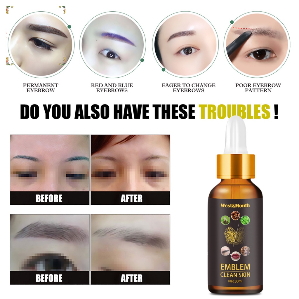 Dung Dịch Tẩy Hình Xăm Vĩnh Viễn Dễ Sử Dụng