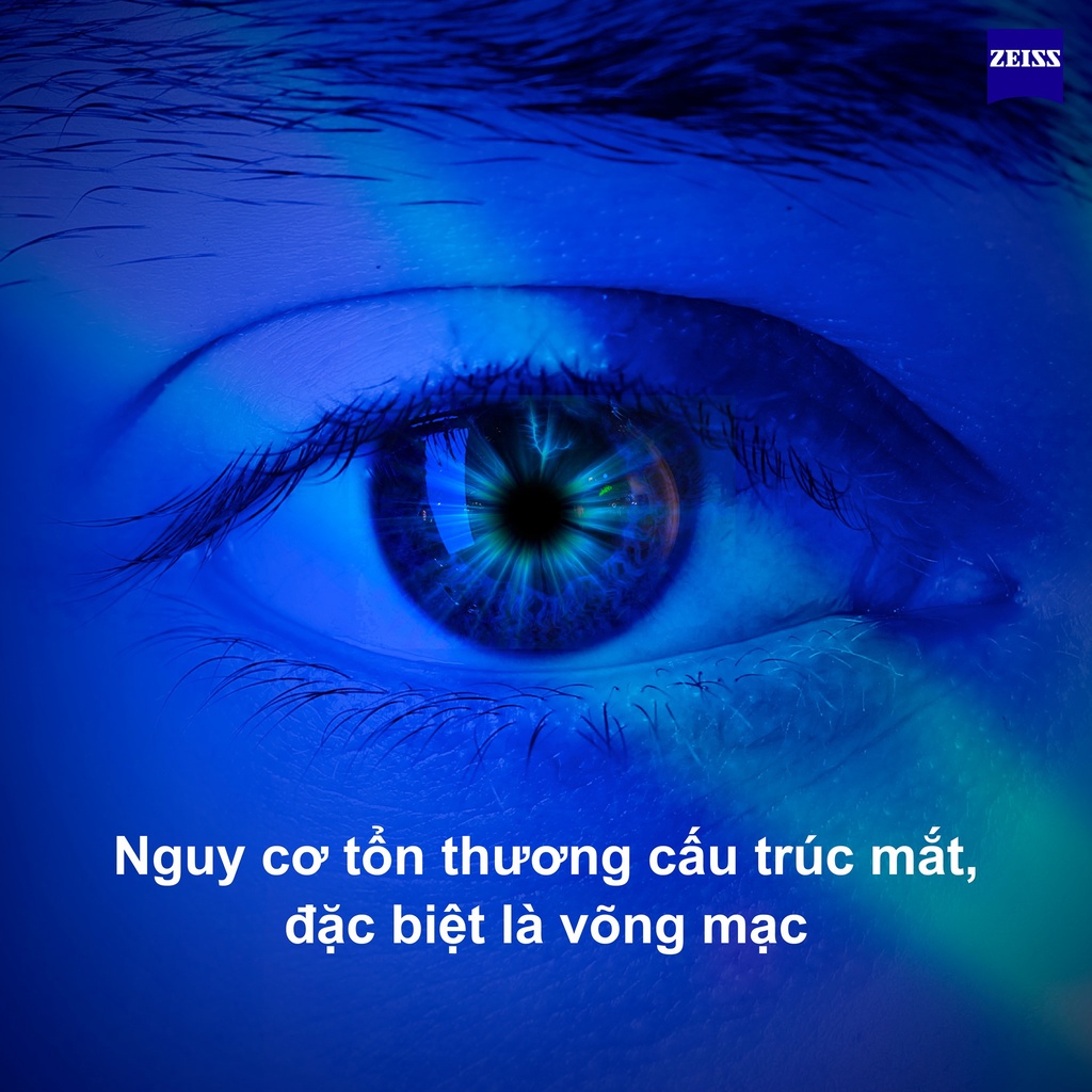 Tròng Kính Zeiss 1.56 Duravision Blue Protect UV Chính Hãng Đức