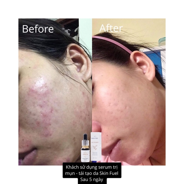 Serum tái tạo làn da Skin Fuel | BigBuy360 - bigbuy360.vn