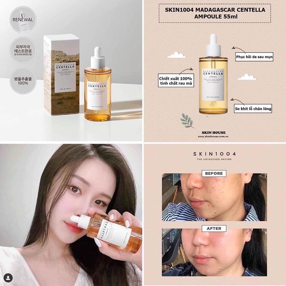 Combo Serum Skin1004 Madagascar Centella Ampoule 55ml - Tinh chất rau má