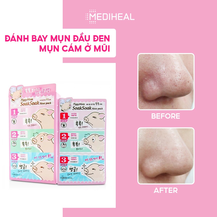 [Nhập mã COSMH22 giảm 8%] Lột Mụn 3 Bước Mediheal PiggyMom Soak Soak Nose Pack [K31]