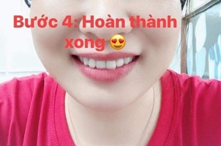 Than hoạt tính trắng răng My smile