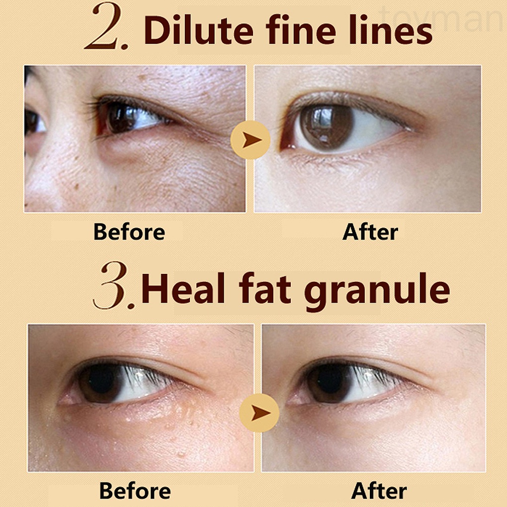 [Hàng mới về] Mặt nạ dưỡng da mắt collagen pha lê vàng chống lão hóa và quầng thâm