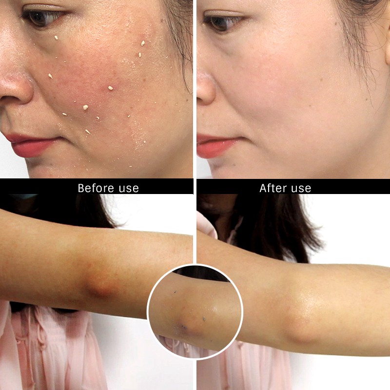 Bộ kem tạo bọt rửa mặt tẩy tế bào chết + mặt nạ ngủ collagen phục hồi sâu OMYLADY