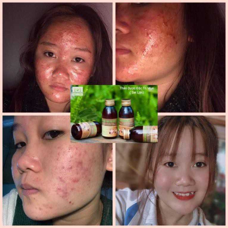 Thảo Dược Đông Y Lê Xuân Handmade( L/130ml) | BigBuy360 - bigbuy360.vn