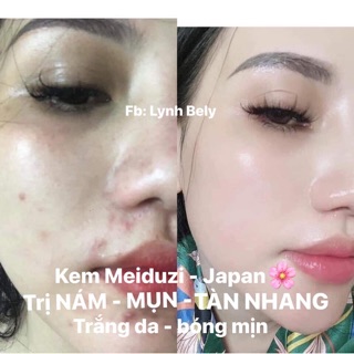 Kem Meiduzi Nhật [HÀNG CÓ TEM]