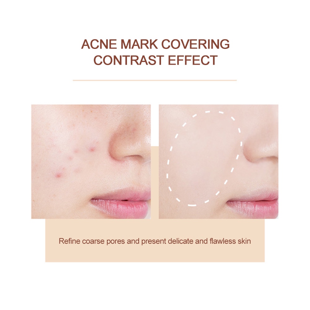 Còn Hàng Kiss Beauty 6 Màu Che Khuyết Điểm Bảng Che Khuyết Điểm Các Đốm Mụn Thâm Rách Máng Bền Chống Nước Trang Điểm kem Che Khuyết Điểm Cá Tuyết