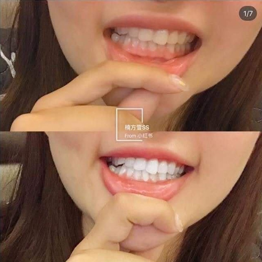 Kem đánh răng Median Dental IQ 93% Hàn Quốc