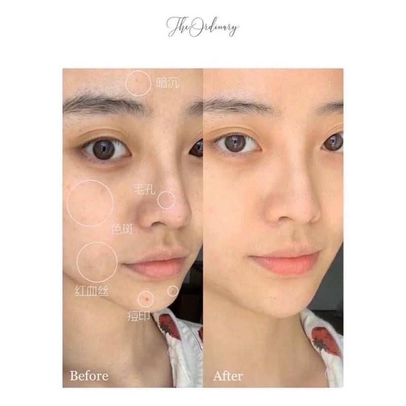 Serum ordinary hyaluronic acid 2%+B5