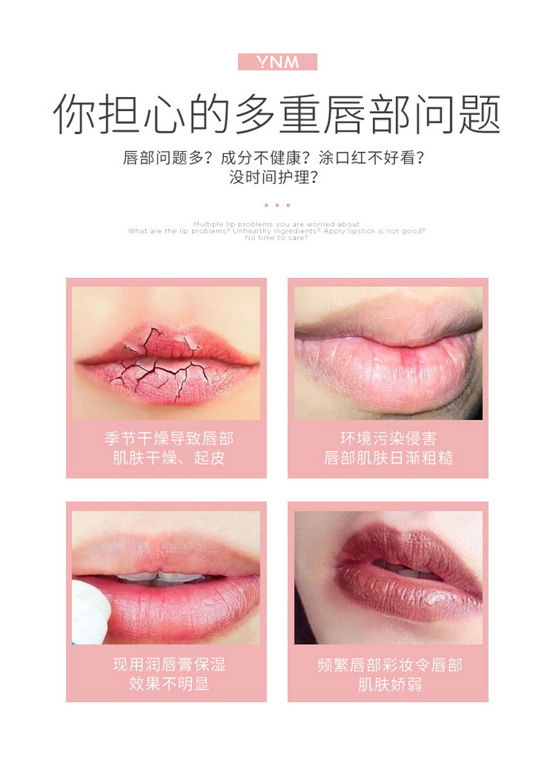 (Hàng Mới Về) Mặt Nạ Dưỡng Môi Chiết Xuất Thực Vật Hàn Quốc Ynm | BigBuy360 - bigbuy360.vn