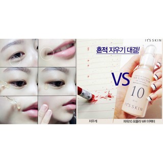 (BILL KOREA) Tinh Chất Dưỡng Da ITSSKIN Power 10 Formula Effector 30ml