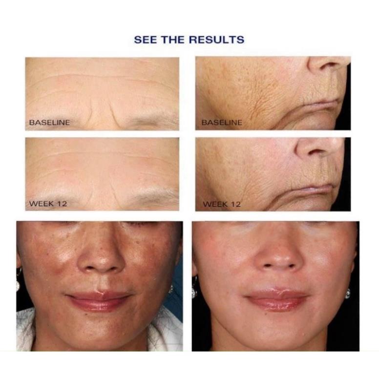 Kem chống lão hóa WRINKLE + TEXTURE REPAIR 30ml/50ml