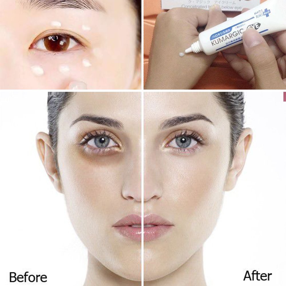 Kem Cải Thiện Thâm Quầng Mắt Kumargic Eye Của Nhật