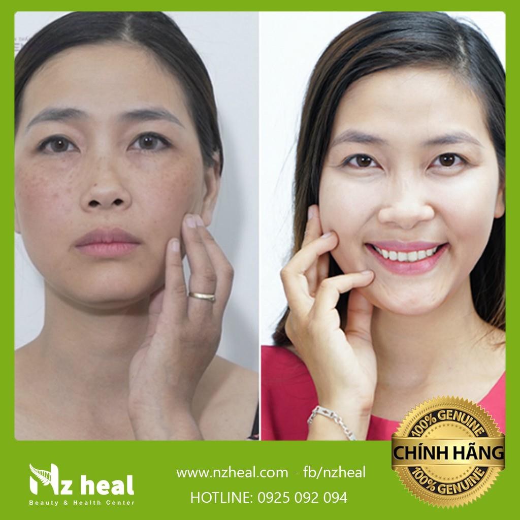 Dầu dưỡng sáng da Living Nature Radiance Night Oil 10ml | BigBuy360 - bigbuy360.vn