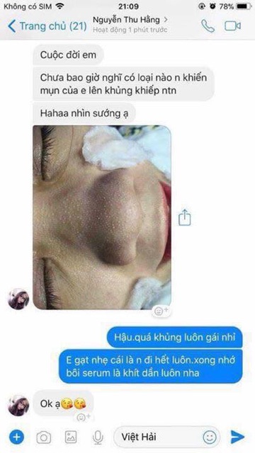 Ủ mụn ohio | BigBuy360 - bigbuy360.vn