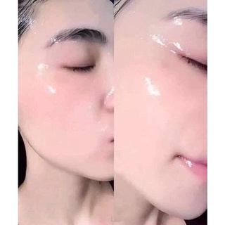 10 Mặt Nạ Nhau Thai Cừu