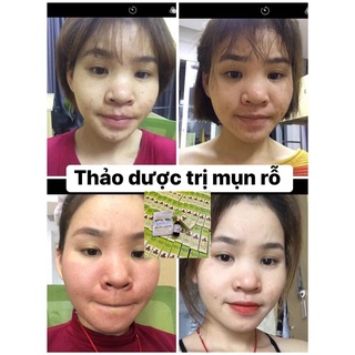 Tái Tạo Da MT (50ml)