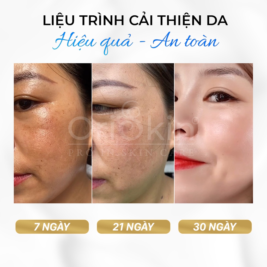 Serum Oriskin White Skin Serum Dưỡng Trắng, Mờ Thâm Nám 30ml