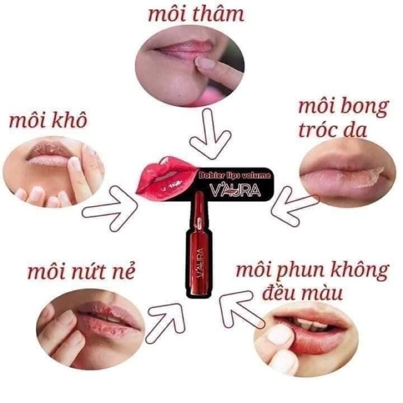 [Mẫu mới]Tinh Chất Cấy Môi Vaura Babier Lips Volume ,mờ thâm làm hồng môi sau 7 ngày | BigBuy360 - bigbuy360.vn