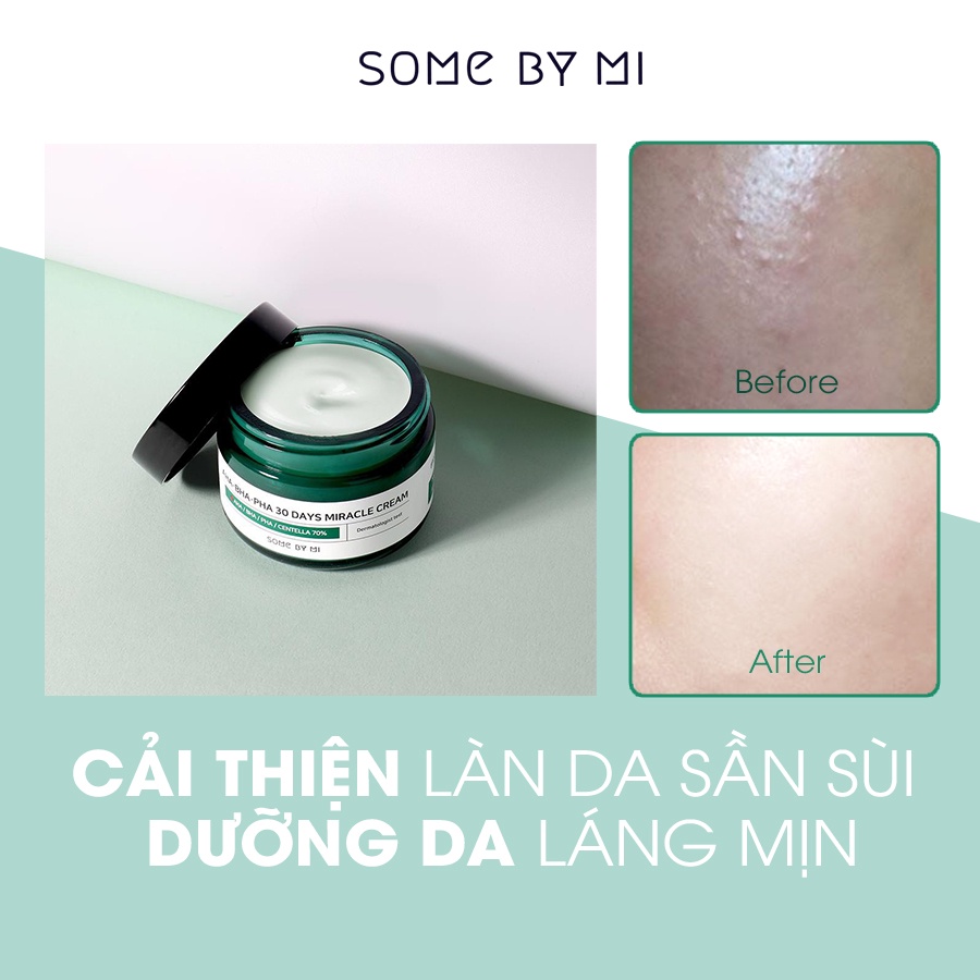 [Mã BMTTC60K giảm đến 60K đơn 50K] Kem Dưỡng Giảm Mụn Some By Mi AHABHAPHA 30 Days Miracle Cream 50ml