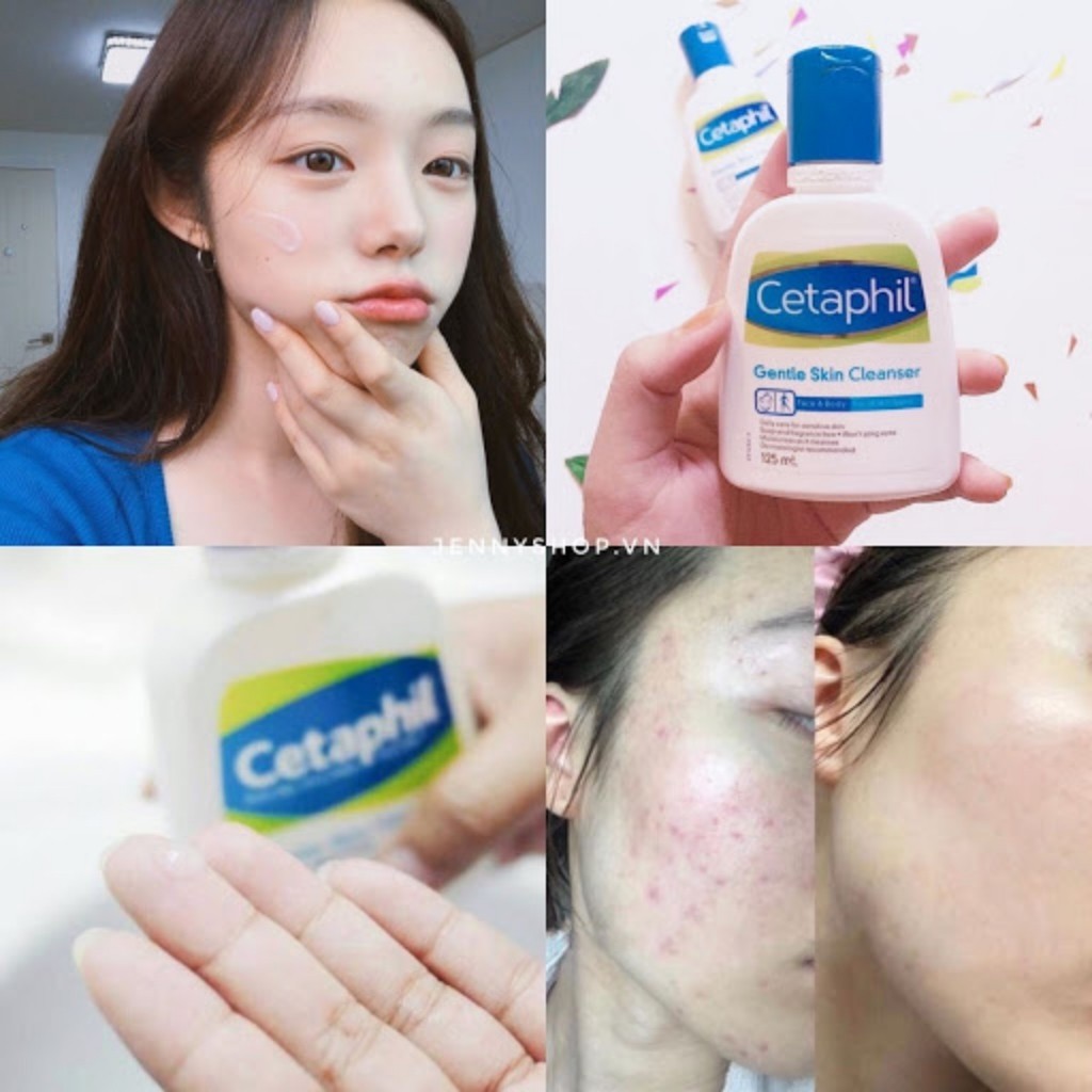 Sữa rửa mặt làm sạch dịu nhẹ Cetaphil Gentle Skin Cleanser ( 500ml,250ml,59ml) dành cho da dầu hoặc cho da khô