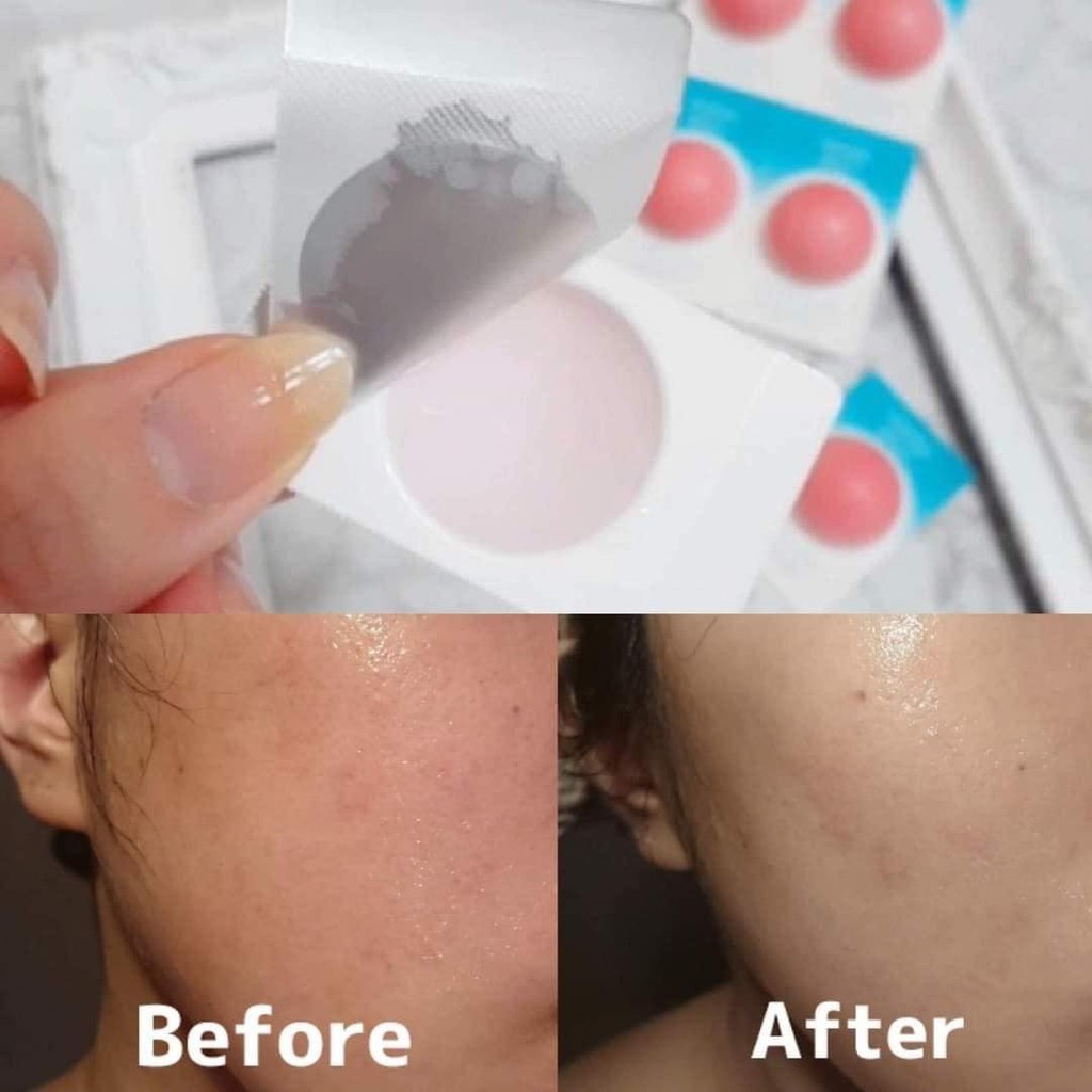 Serum Đào Tươi MOMOPURI Phục Hồi Da Cấp Tốc Nhật Bản