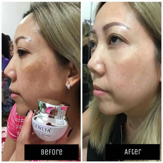 Mỹ phẩm Cenlia
