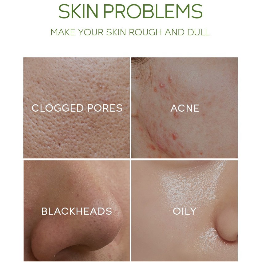 Hộp 20 gói mặt nạ bùn làm sạch da kiềm dầu trà xanh Fenyi Green Tea Mud Mask Sena Beauty