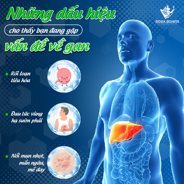 Viên uống giải độc gan Liver Protect làm mát gan tăng cường chức năng gan lọ 60 viên Rosa Bonita