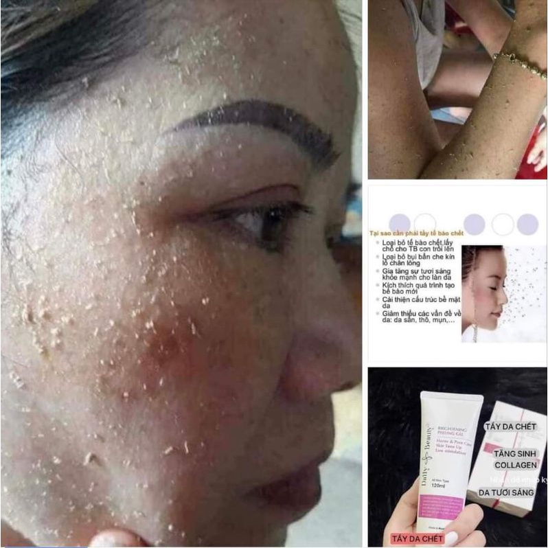 Tẩy Da Chết Vật lý