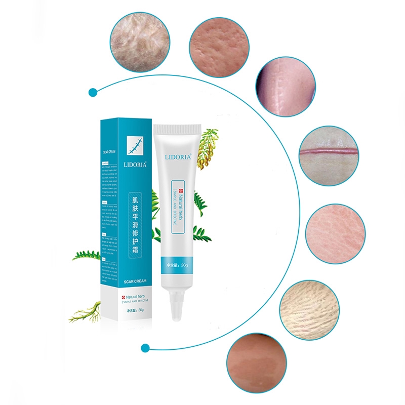 [Hàng mới về] Kem Hỗ Trợ Giảm sẹo dược liệu LIDORIA an toàn và hiệu quả | BigBuy360 - bigbuy360.vn