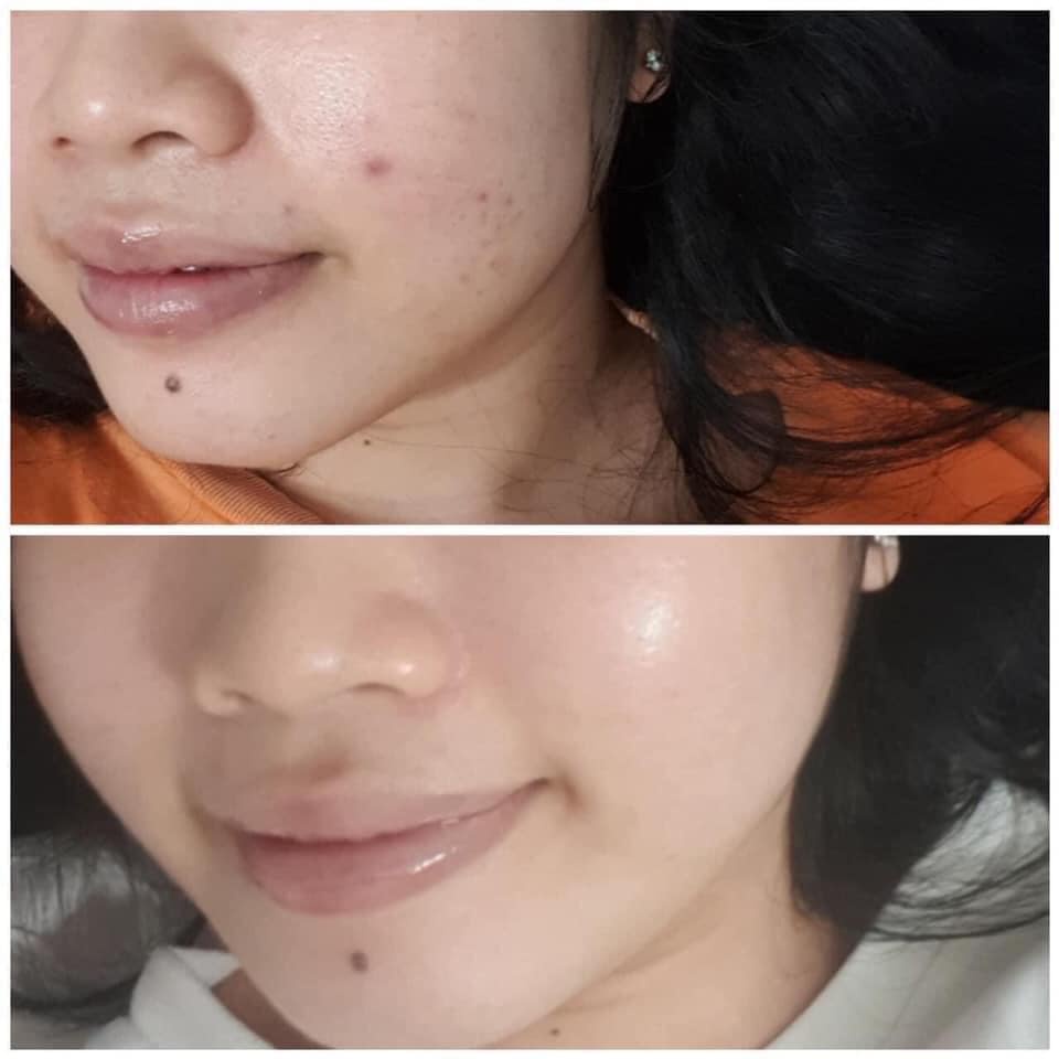 Serum Tái Tạo Da DR.WU Mandelic Acid 6% 8% 18% Mandelik Renewal 15ml Đài Loan