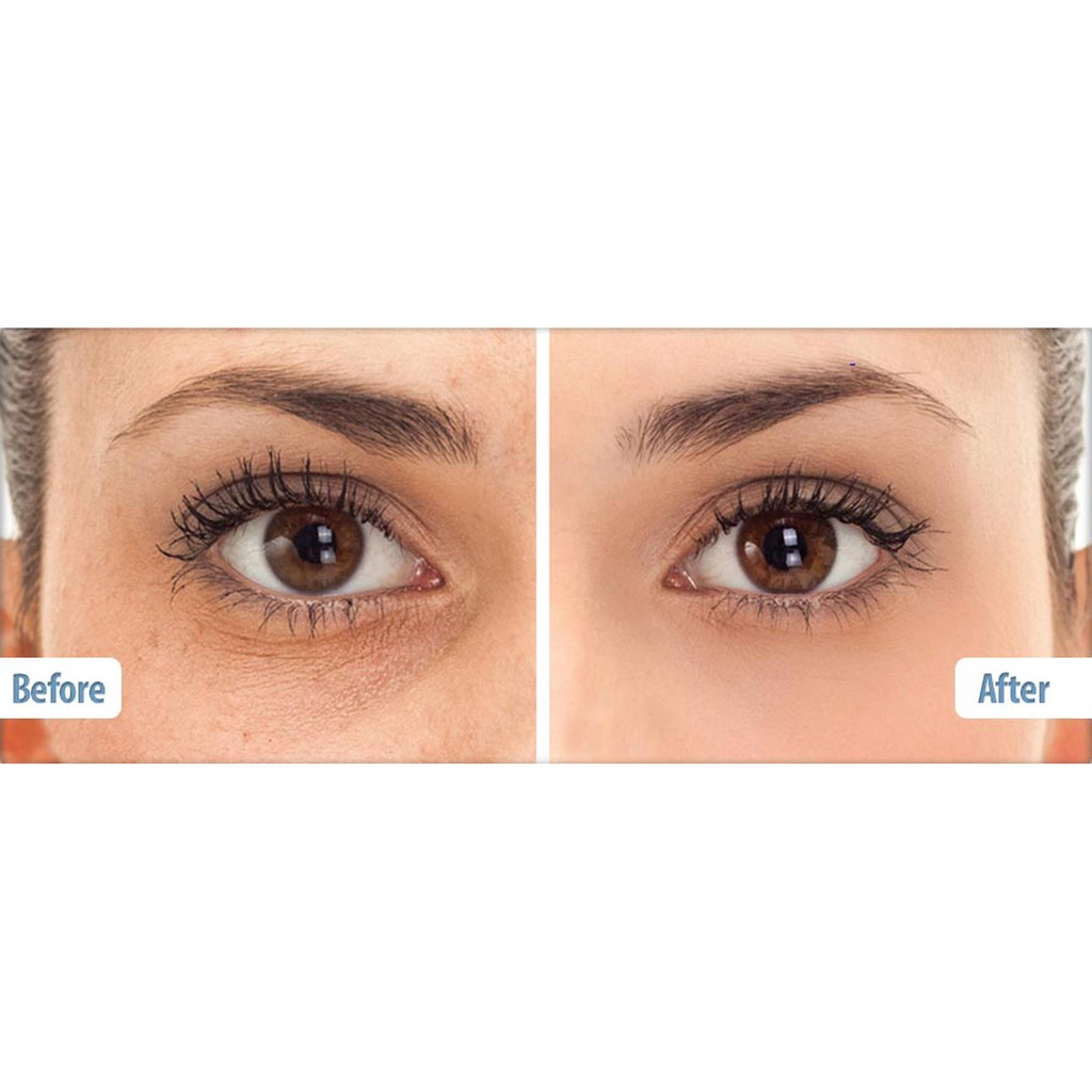 Combo Serum cấp nước Balance Hyaluronic Deep Moisture và Tinh chất dưỡng mắt Balance active formula gold collagen