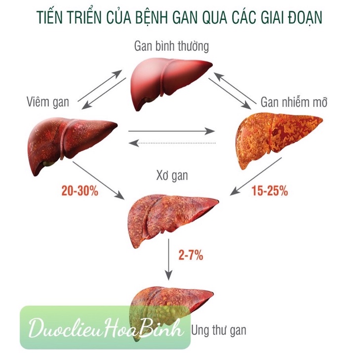 Cà Gai Leo Chuẩn Sạch Hoà Bình- khắc tinh các bệnh về Gan