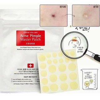 Miếng dán mụn Cosrx Acne Pimple Master 24 miếng màu đỏ