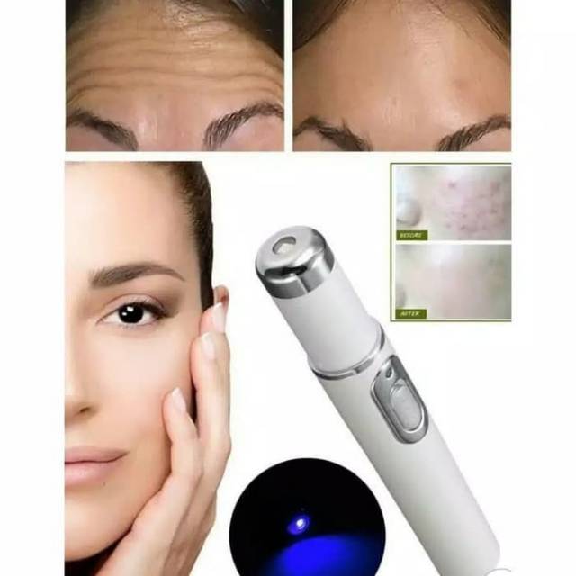 (Hàng Mới Về) Bút Laser Trị Mụn Chất Lượng Cao