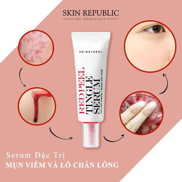 Serum peel da hóa học RED PEEL TINGLE SERUM - PEEL DA KHÔNG BONG TRÓC