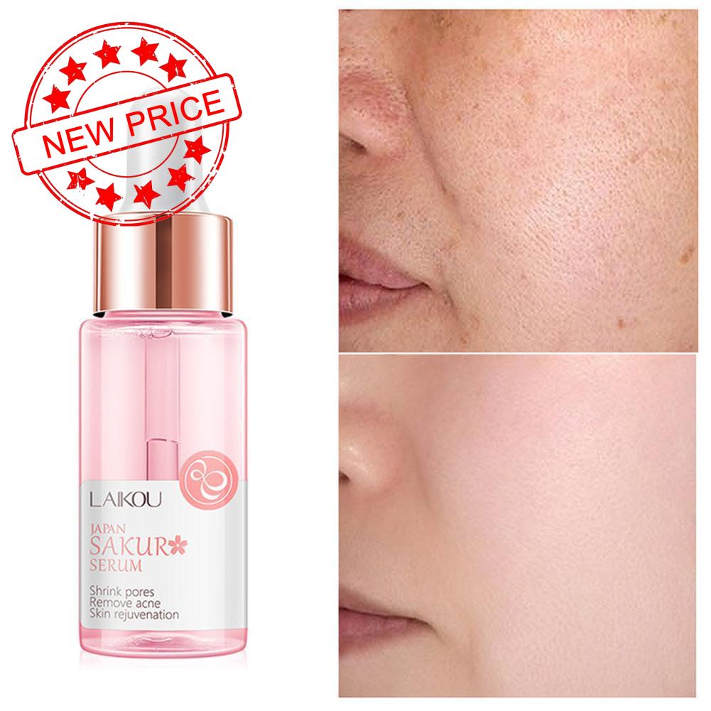 Tinh chất hoa anh đào LAIKOU 15ml V0K7 dưỡng ẩm làm săn chắc da